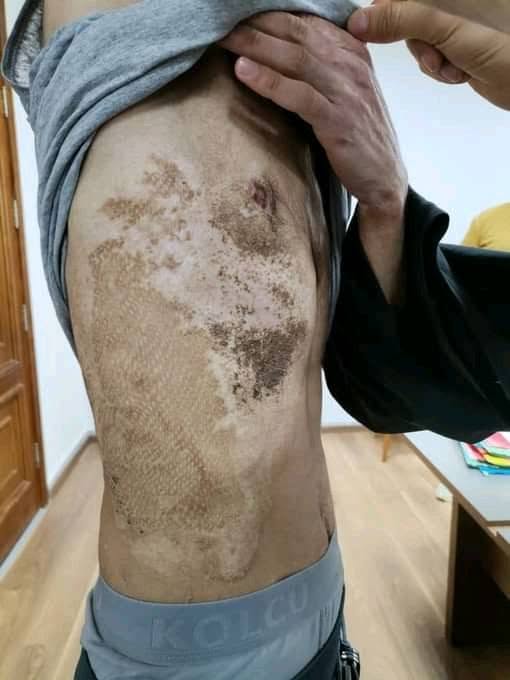 YC42B0